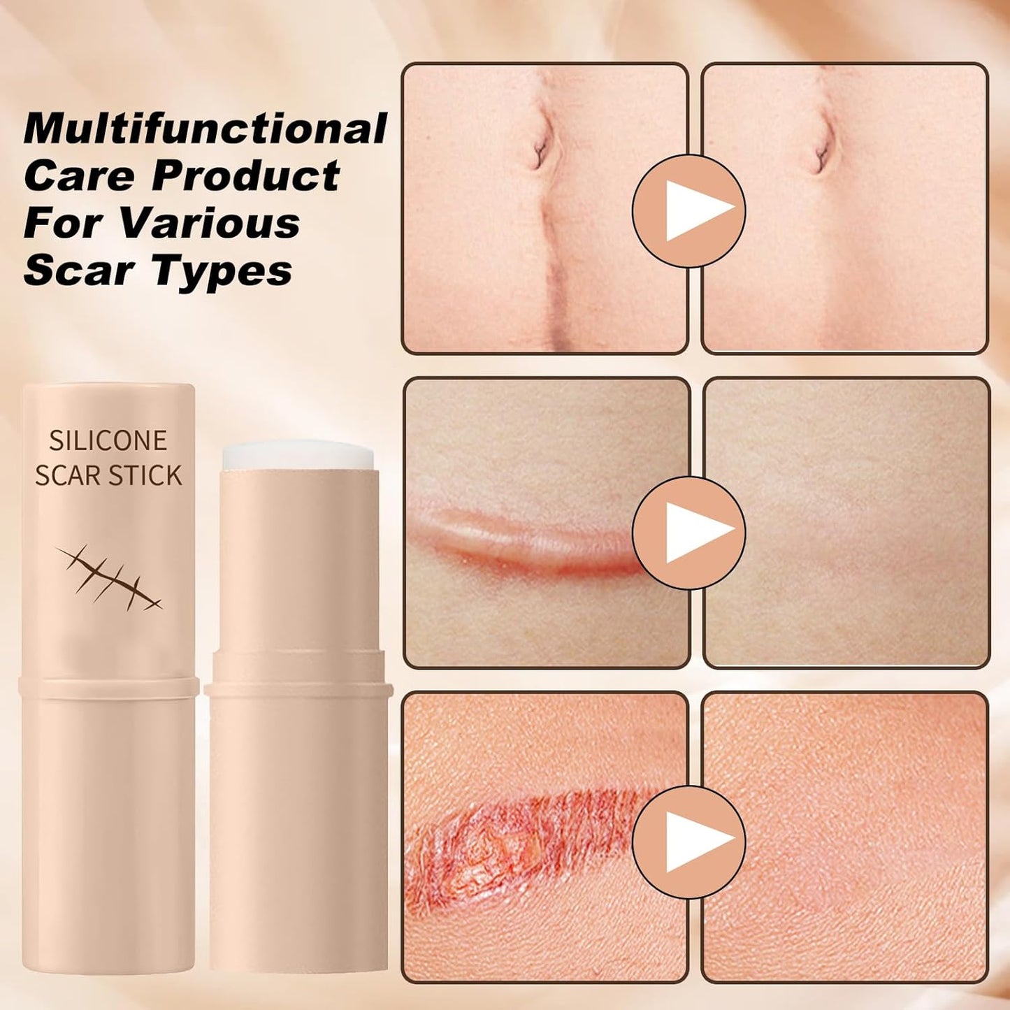 Advanced Silicone Scar Care Stick