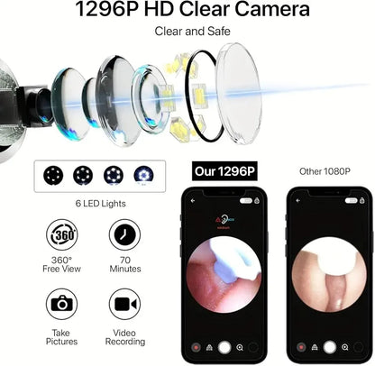 Smart™ Visual Ear Wax Cleaner