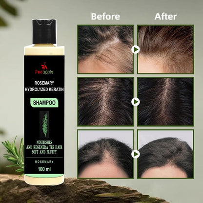 🌿 Rosemary Hydrolyzed Keratin Shampoo (100 ml each, Pack of 2)