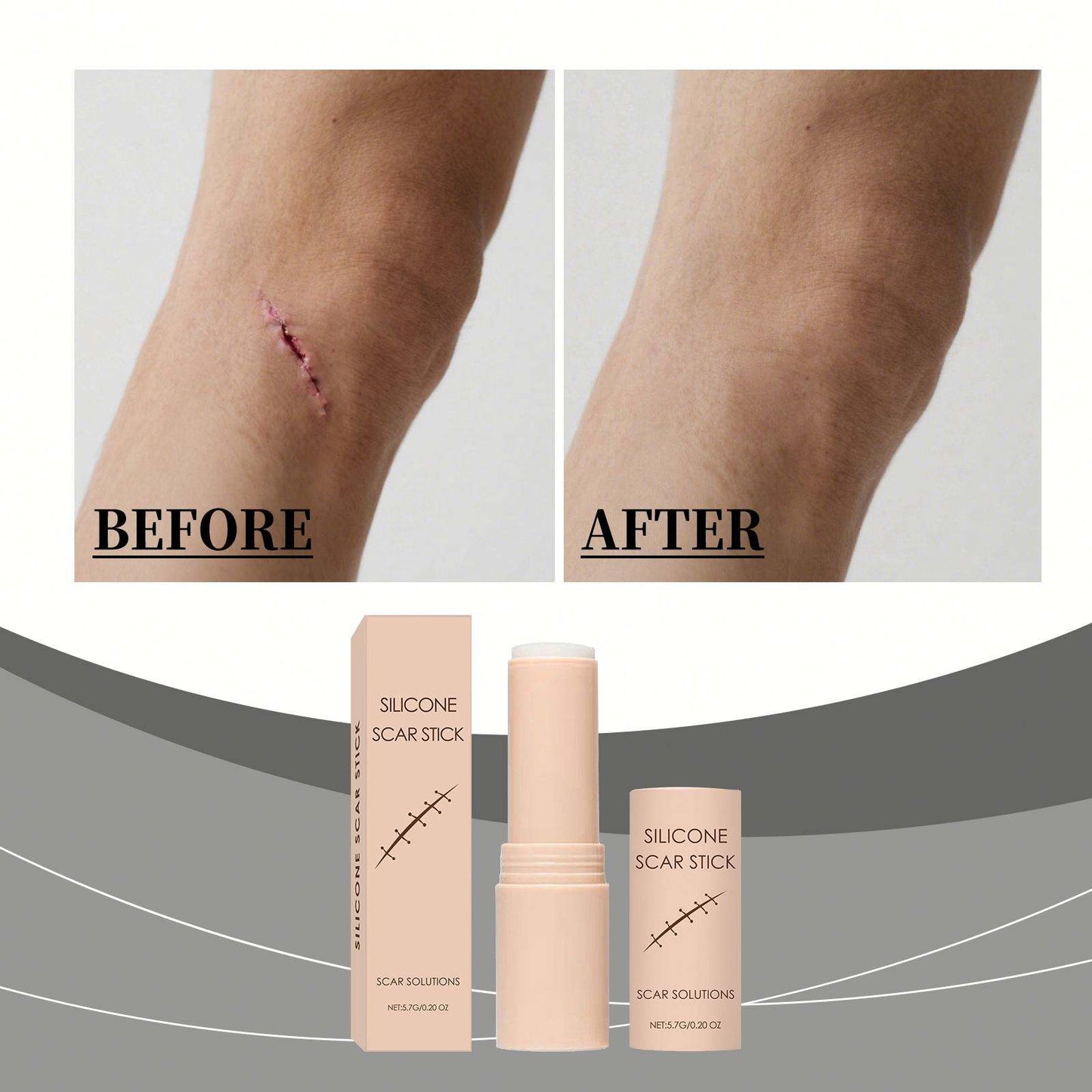 Advanced Silicone Scar Care Stick