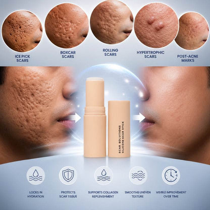 4-in-1 Scar Care Stick