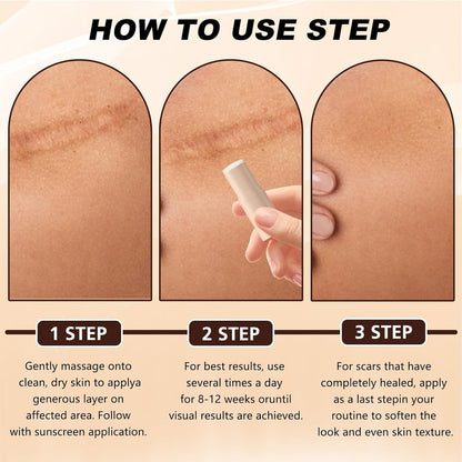Advanced Silicone Scar Care Stick